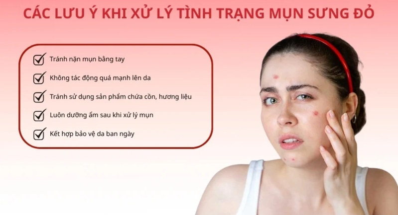 Xử lý mụn sưng đỏ cần ưu tiên làm dịu da, giảm viêm và tránh tác động mạnh lên nốt mụn. 